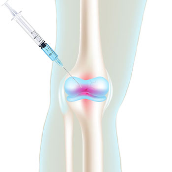 The Acoustic waves induce microtrauma in damaged tissues